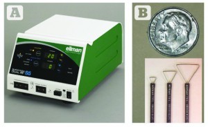 Figure 1 (A) The Ellman 4.0 MHz radiowave generator (B) with specialised rhinophyma electrodes