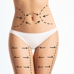 ISAPS Global Survey Reports a Rise in Aesthetic Surgery