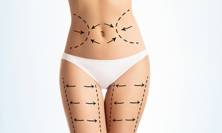 ISAPS Global Survey Reports a Rise in Aesthetic Surgery