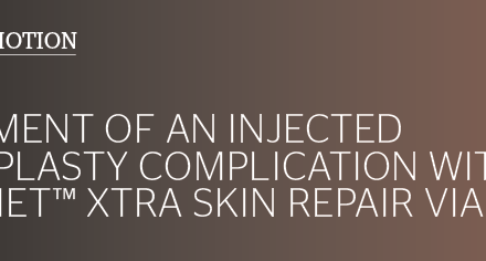 Treatment of an injected rhinoplasty complication with SIMILDIET™ Xtra Skin Repair vials