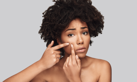 People with darker skin disproportionately suffer from acne’s psychological impacts
