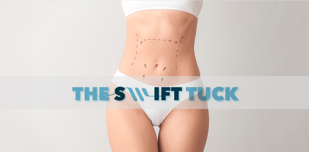 World-Class Practice, The Warner Institute, Debuts First-Of-Its-Kind SWIFT Tuck Procedure