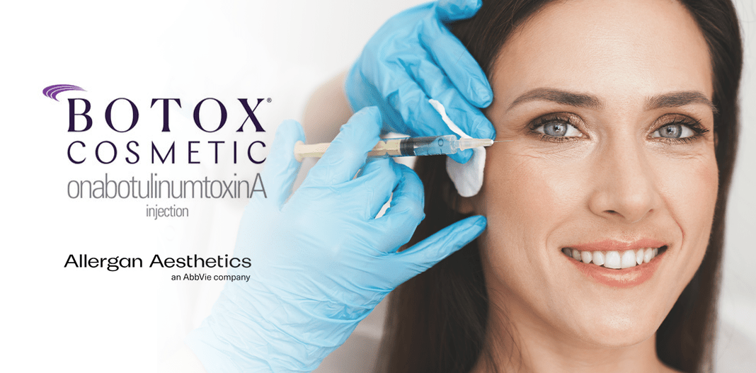 ALLERGAN AESTHETICS ANNOUNCES OPEN CASTING CALL FOR BOTOX® COSMETIC (ONABOTULINUMTOXINA)