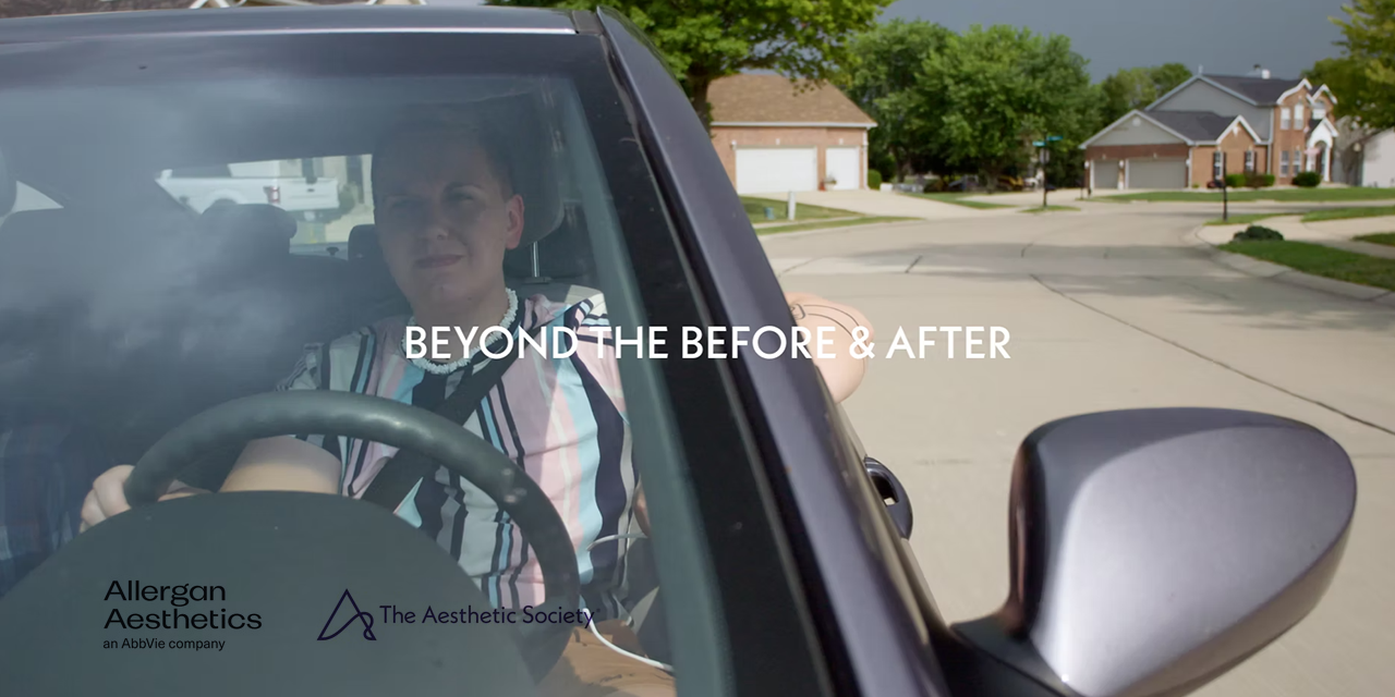 ‘BEYOND THE BEFORE & AFTER’ IS UNVEILED BY THE AESTHETIC SOCIETY, AN ORIGINAL DOCUSERIES SPONSORED BY ALLERGAN AESTHETICS